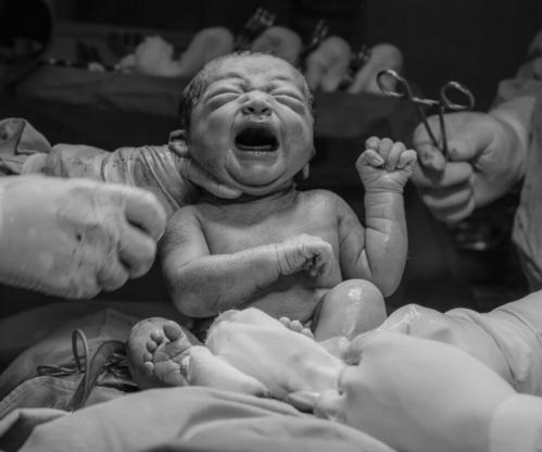 Relax, breath, birth: Unpacking the science behind hypnobirthing | Bona