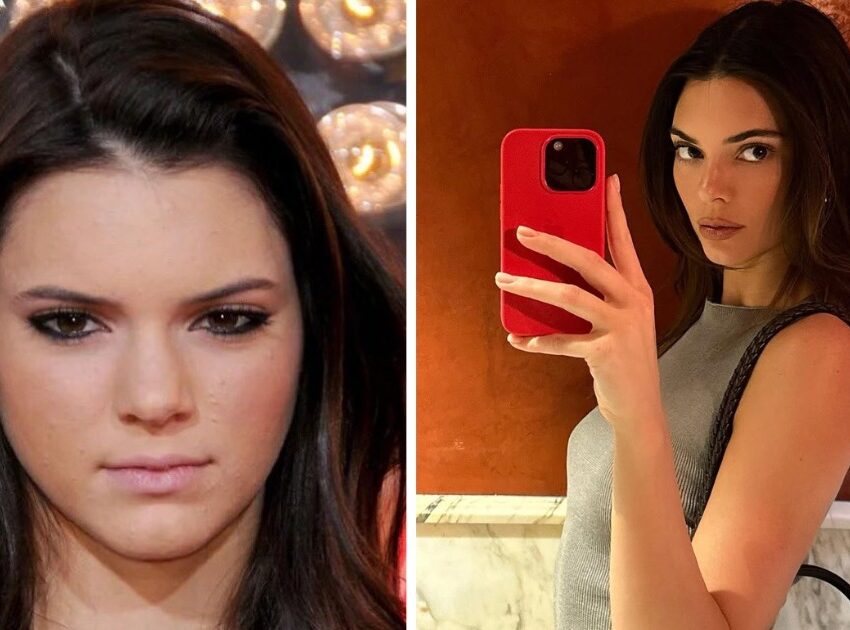 Kendall Jenner interview 2026, Kendall Jenner natural look debate, celebrity cosmetic surgery discussion, Kardashian Jenner beauty standards, Bona Magazine