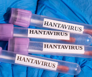 ANKARA, TURKIYE - MAY 06: In this photo illustration Hantavirus samples are seen in Ankara, Turkiye on May 06,, 2026. (Photo by Arman Onal/Anadolu via Getty Images)