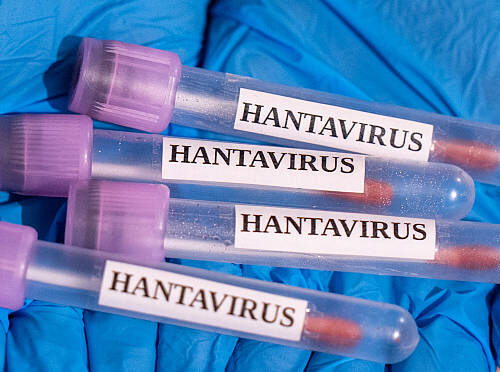 ANKARA, TURKIYE - MAY 06: In this photo illustration Hantavirus samples are seen in Ankara, Turkiye on May 06,, 2026. (Photo by Arman Onal/Anadolu via Getty Images)