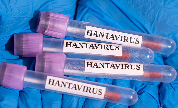 ANKARA, TURKIYE - MAY 06: In this photo illustration Hantavirus samples are seen in Ankara, Turkiye on May 06,, 2026. (Photo by Arman Onal/Anadolu via Getty Images)
